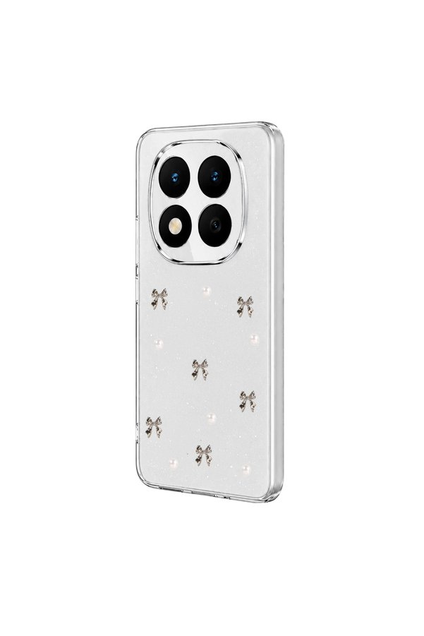 Evi̇mdeyokyok Xi̇aomi̇ Redmi̇ Note 15 Pro Plus 5G Fi̇yonk Desenli̇ Kapak - Desen 8
