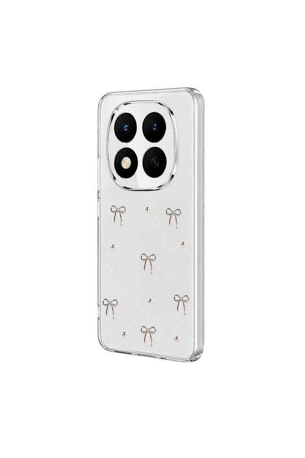 Evi̇mdeyokyok Xi̇aomi̇ Redmi̇ Note 15 Pro 5G Fi̇yonk Desenli̇ Kapak - Desen 5