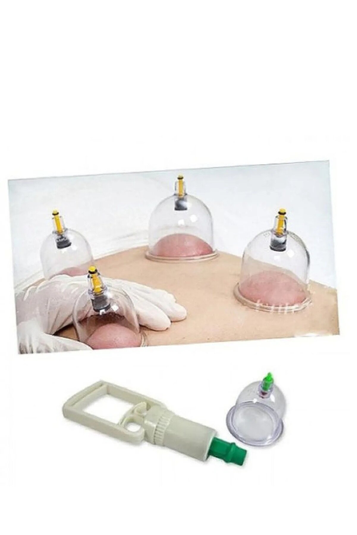 Edi̇kli̇ Store Hacamat Seti̇ Hortumlu - Vakumlu Hortumlu Kupa &Ccedil;ekme Seti̇ (Model 3)