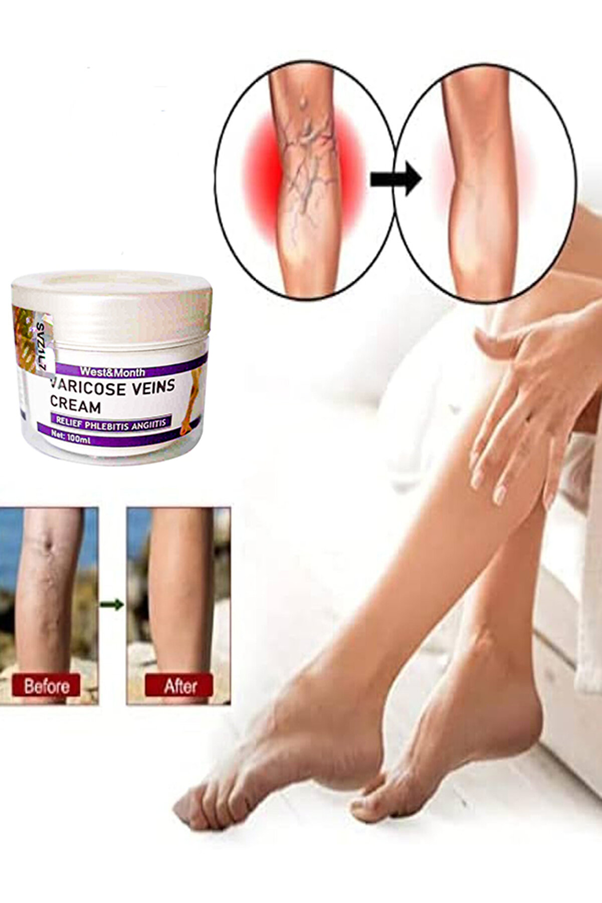 Ekince Varicose and Spider Veins Soothing Leg Cream Bacak Bakım Kremi 100 ml
