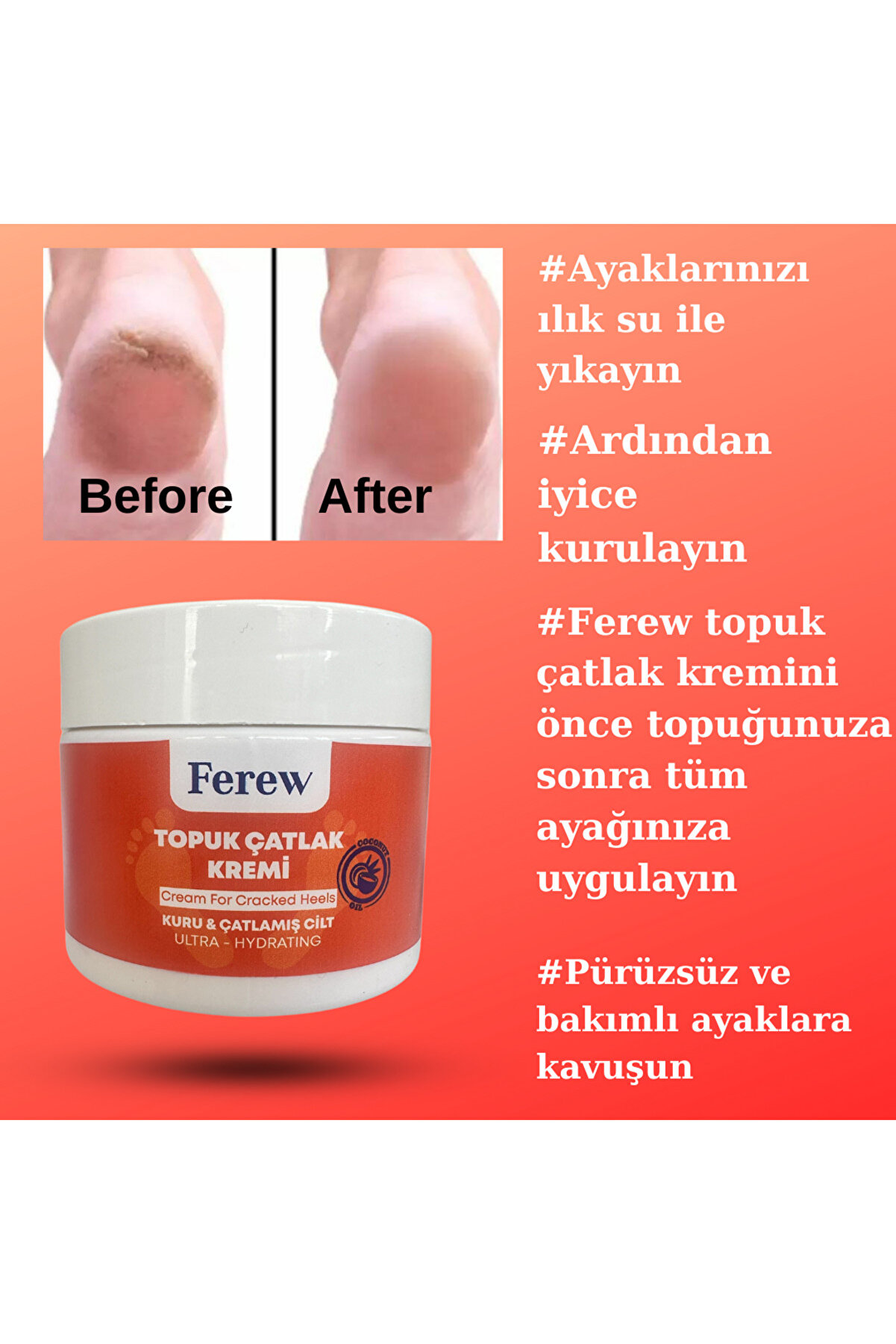 Topuk Çatlak Kremi̇ 100 Ml