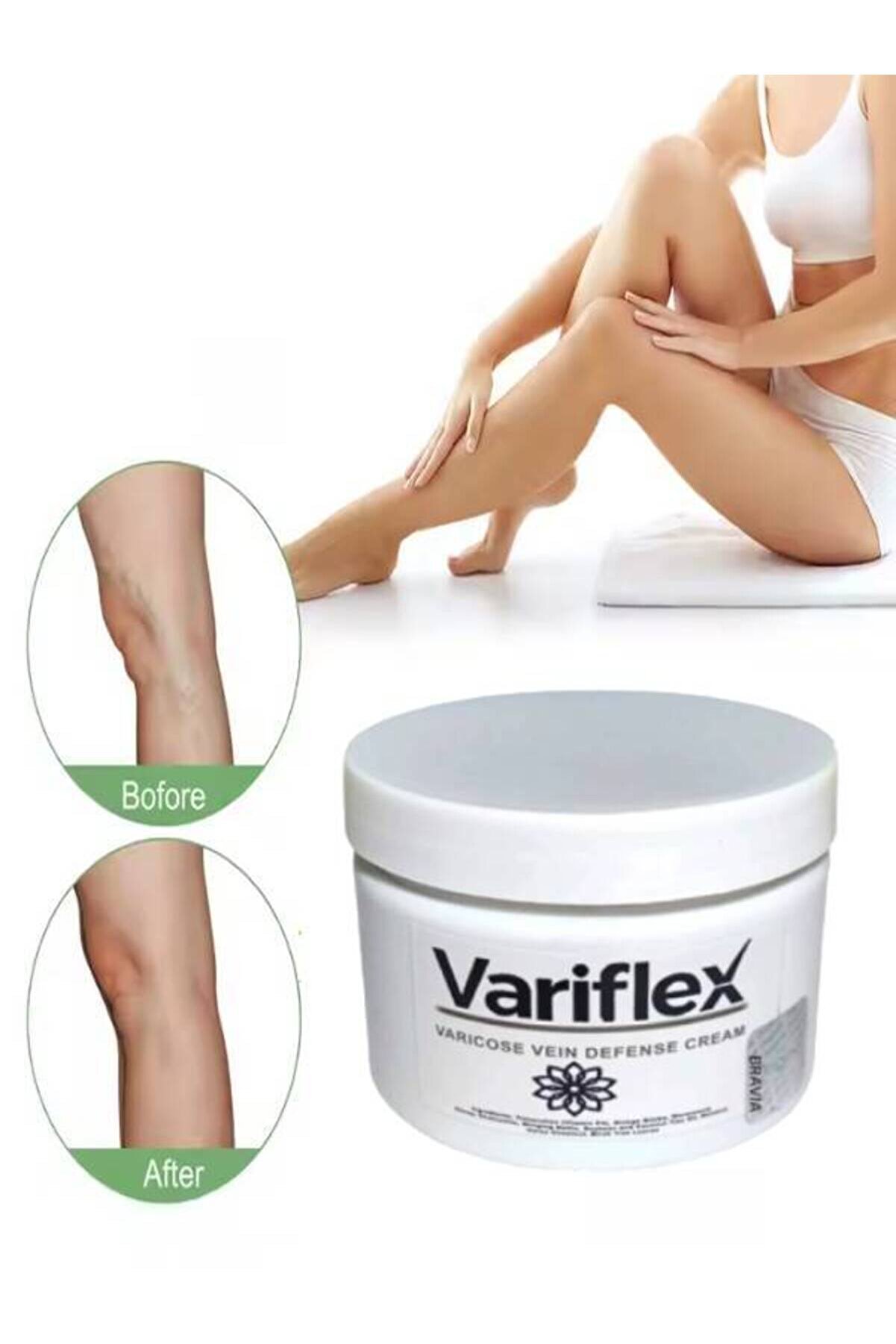 Adoil Variflex Kadınlar İçin Varicosel-Selulıt Bakım Creami 150 ml x 1 adet