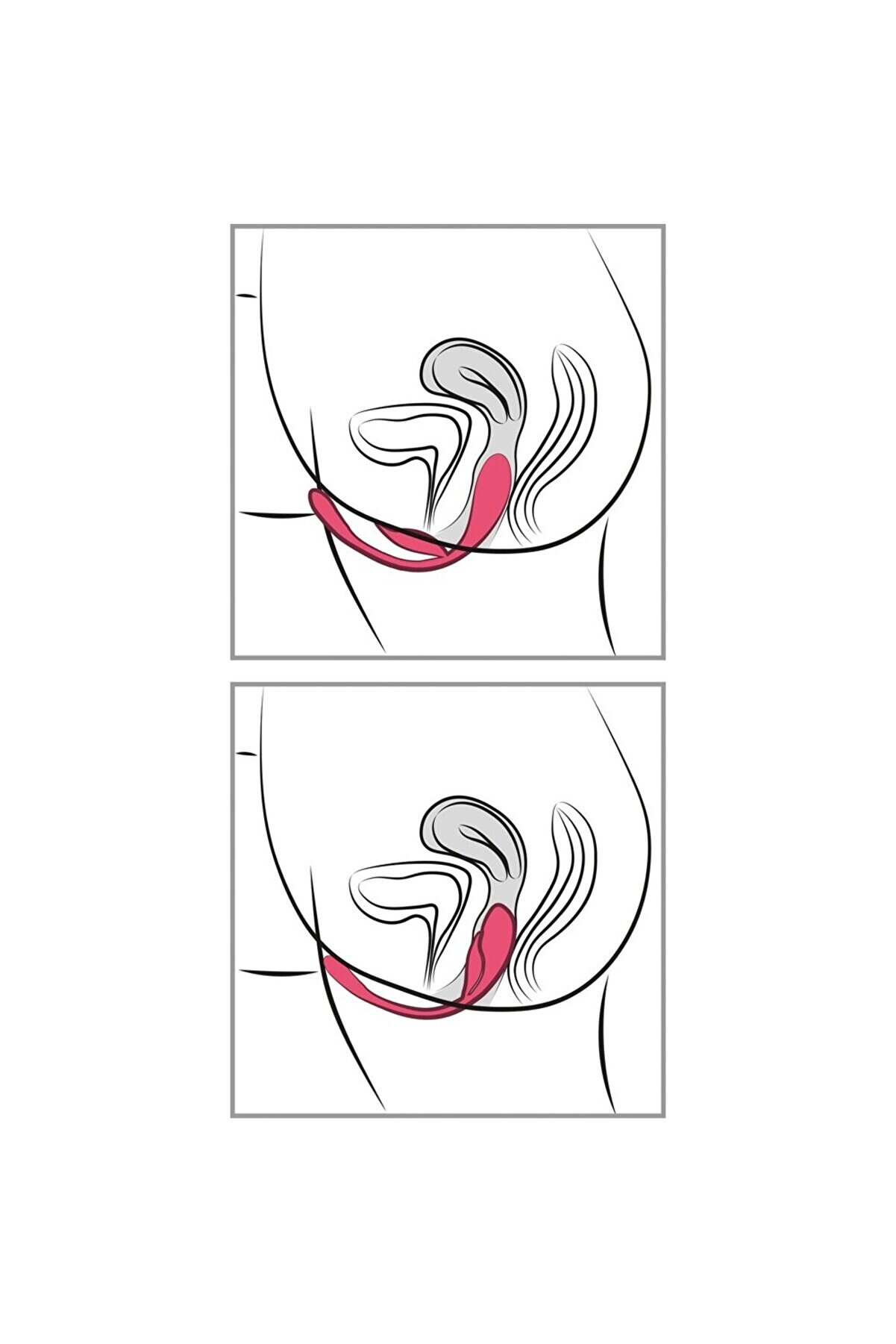 Erox Rc Double Pleasure Love Ball Uzaktan Kumandalı &Ccedil;i̇ft Zevk Topu Vi̇brat&ouml;r