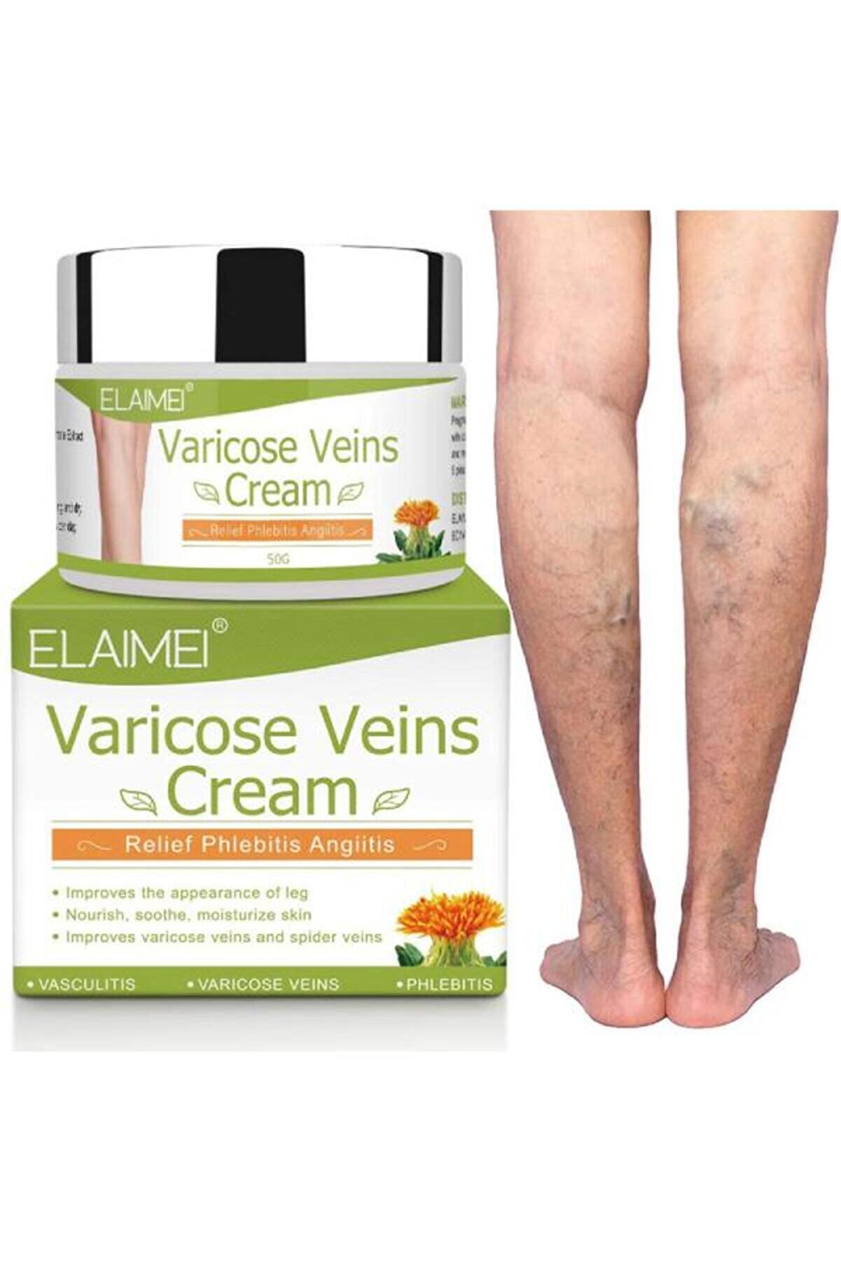 Spi̇der Vari̇cose Vei̇ns Var.i̇s Di̇z Bacak Ayak Bakım Kremi̇ 1 Adet X 100 Ml