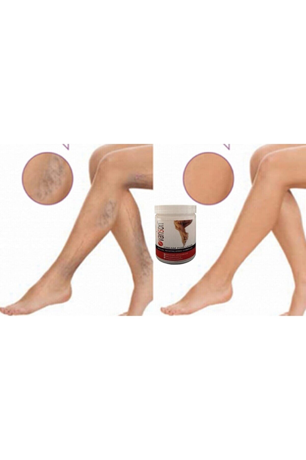 Vari̇son Va.ri̇s Selü.li̇t Bacak Bakım Kremi̇ 200 Ml X 2Adet
