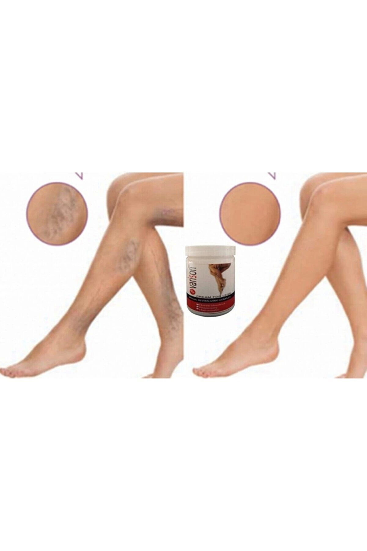 On Selülli̇t Bacak Bakım Kremi̇ 200 Ml X 2Adet