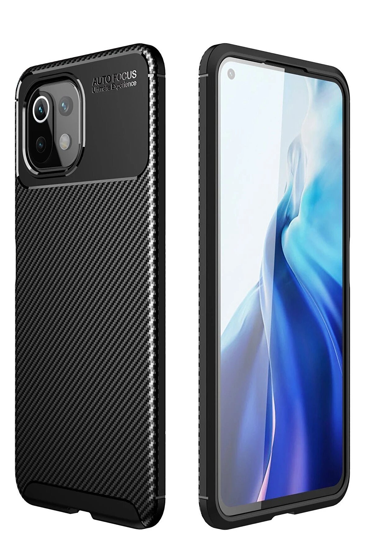 CepteToptan Xiaomi Mİ 11 Lite Kılıf Auto Focus Karbon Kapak - Siyah - DROPX7793-1733