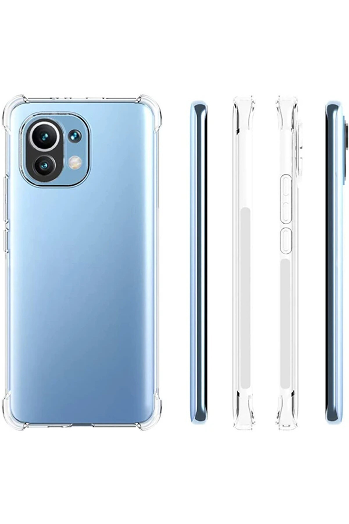 Xi̇aomi̇ Mi̇ 11 Li̇te Kamera Korumalı Shockproof Şeffaf Si̇li̇kon Kılıf-(5775) - Gms5911-1522