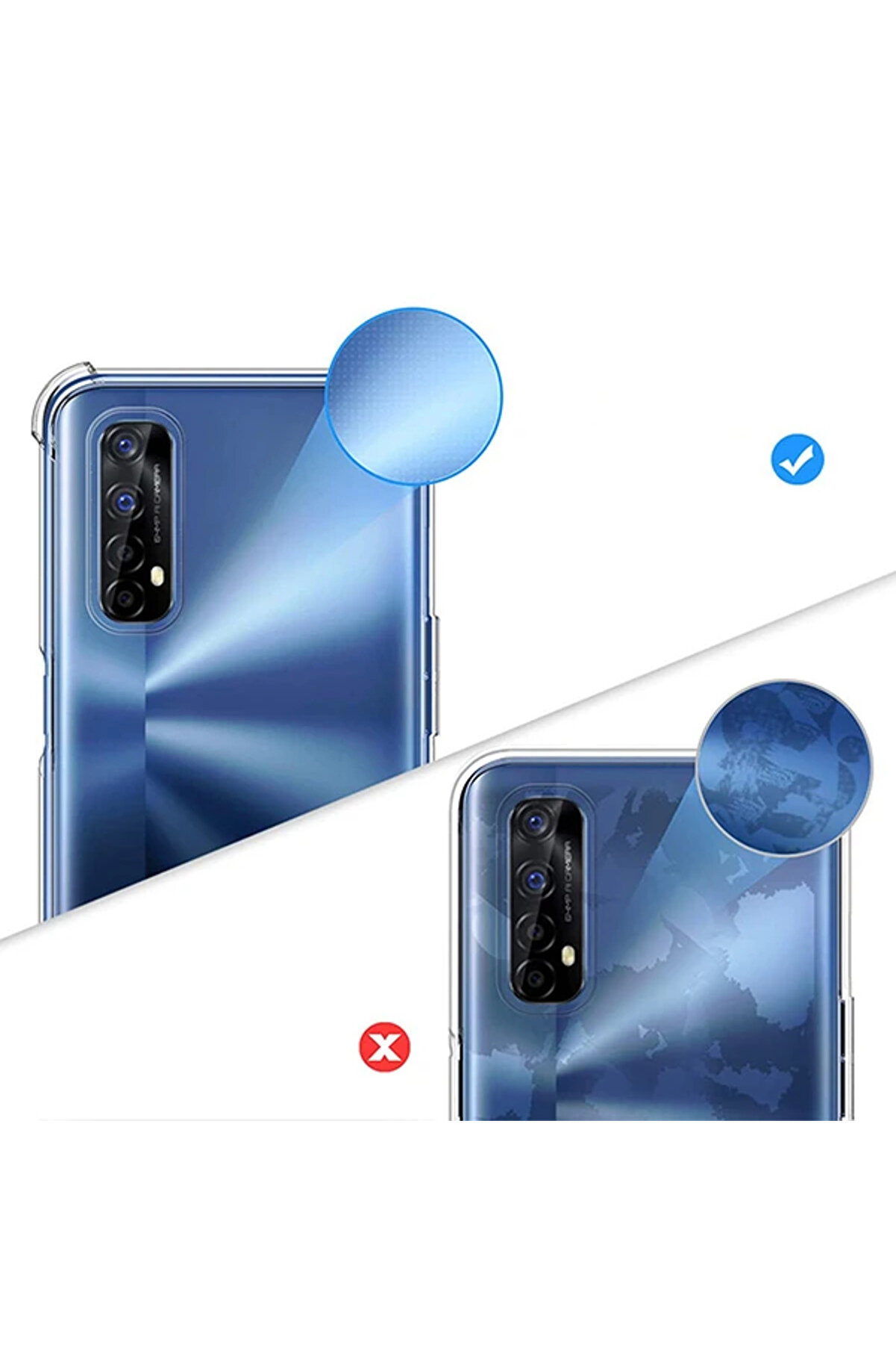 Ally Oppo Realme 7 Anti̇-Drop Si̇li̇kon Kılıf Shockproof Kılıf-(1903) - Dropx1658-7504