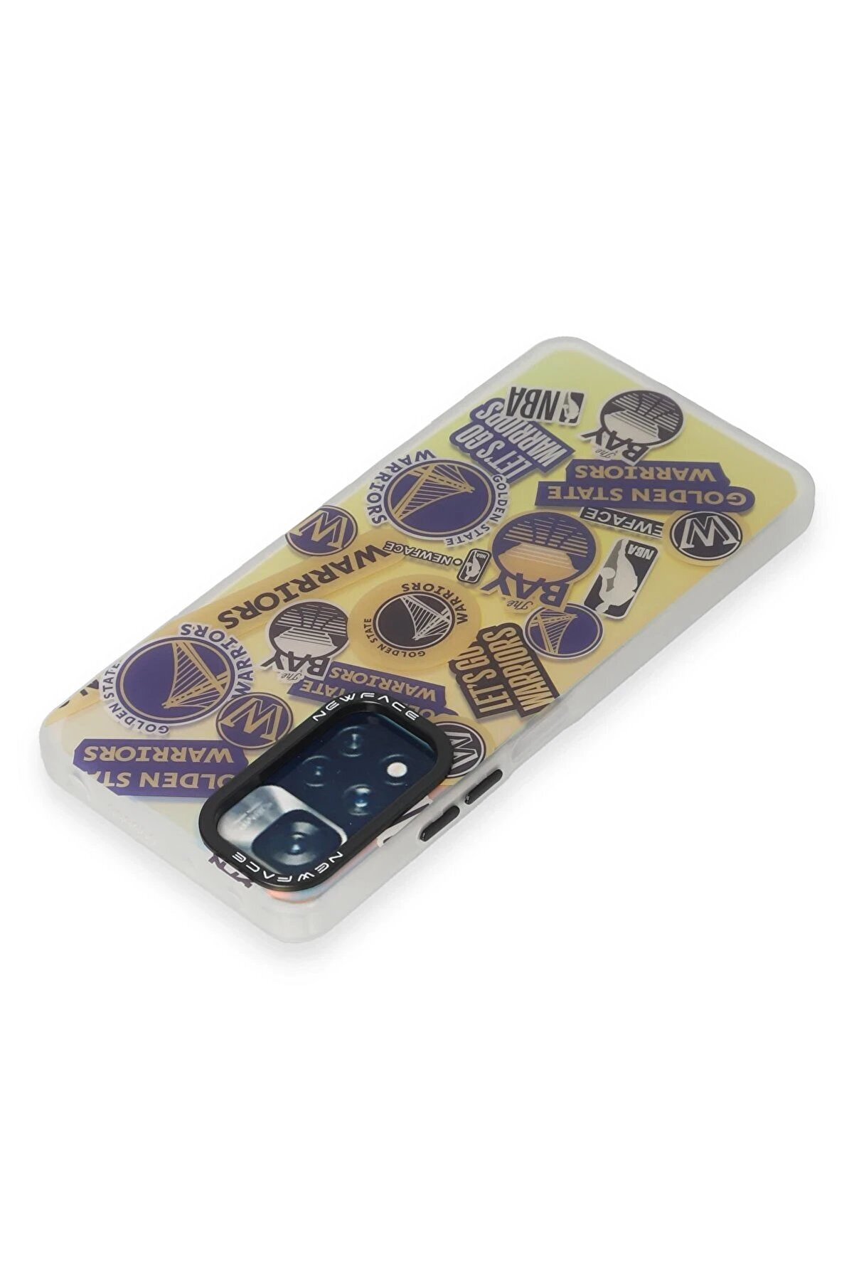 Xi̇aomi̇ Redmi̇ Note 11 Pro Kılıf Estori̇l Desenli̇ Kapak - Estori̇l - 13 - Dropx4952-5281