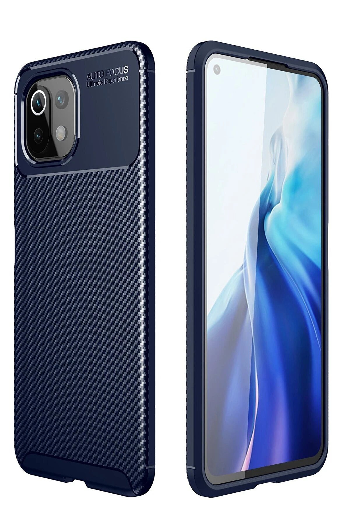 CepteToptan Xiaomi Mİ 11 Lite Kılıf Auto Focus Karbon Kapak - Lacivert - DROPX5819-1813