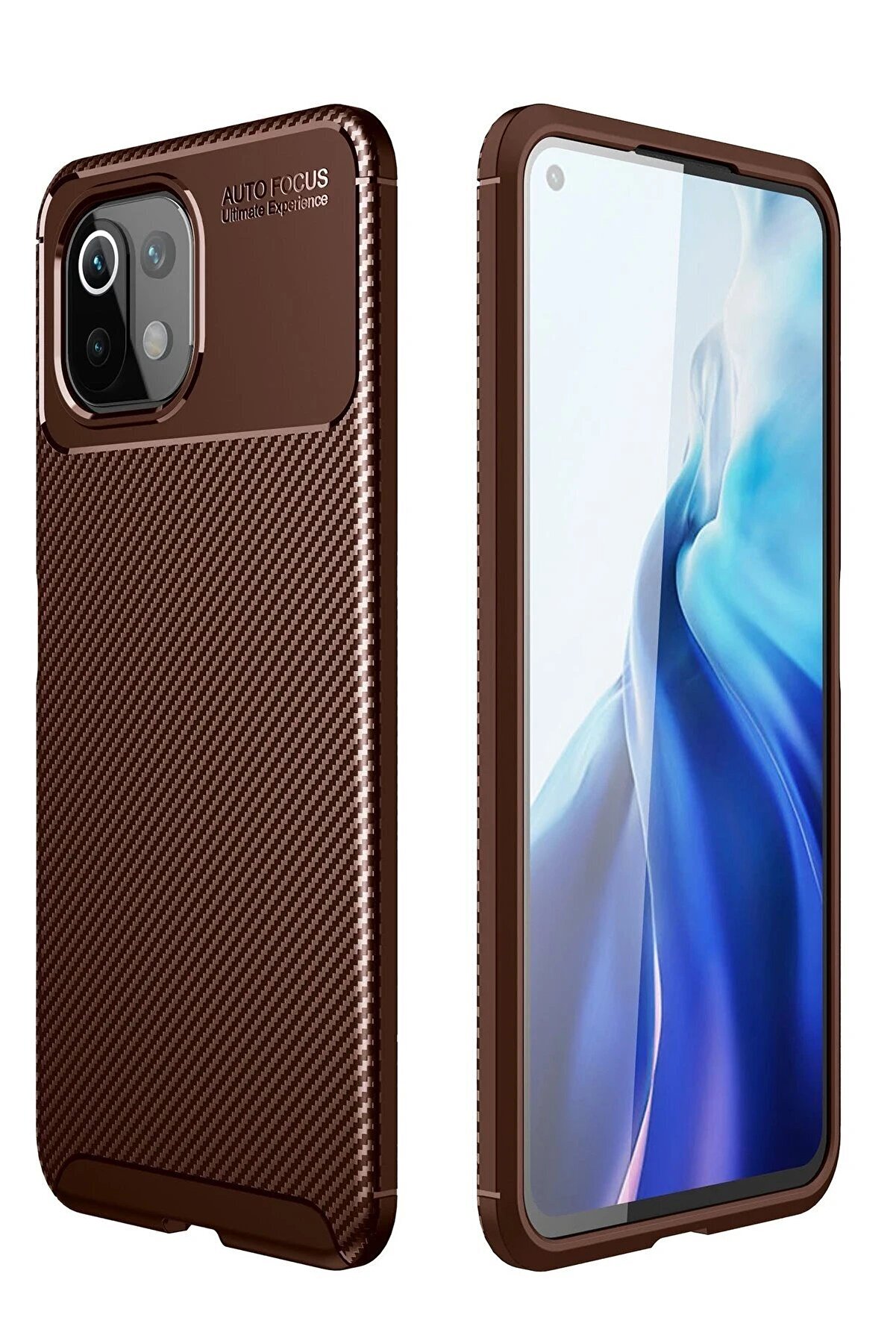 CepteToptan Xiaomi Mİ 11 Lite Kılıf Auto Focus Karbon Kapak - Kahverengi - DROPX5517-9102