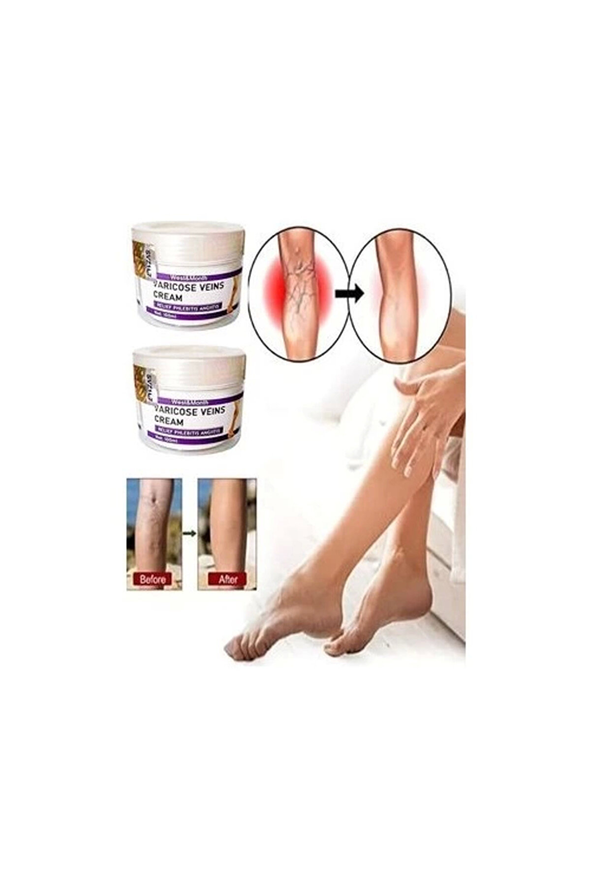 Adoi̇l Vari̇cose And Spi̇der Vei̇ns Soothi̇ng Leg Cream Bacak Bakım Kremi̇ 100 Ml X 2 Adet