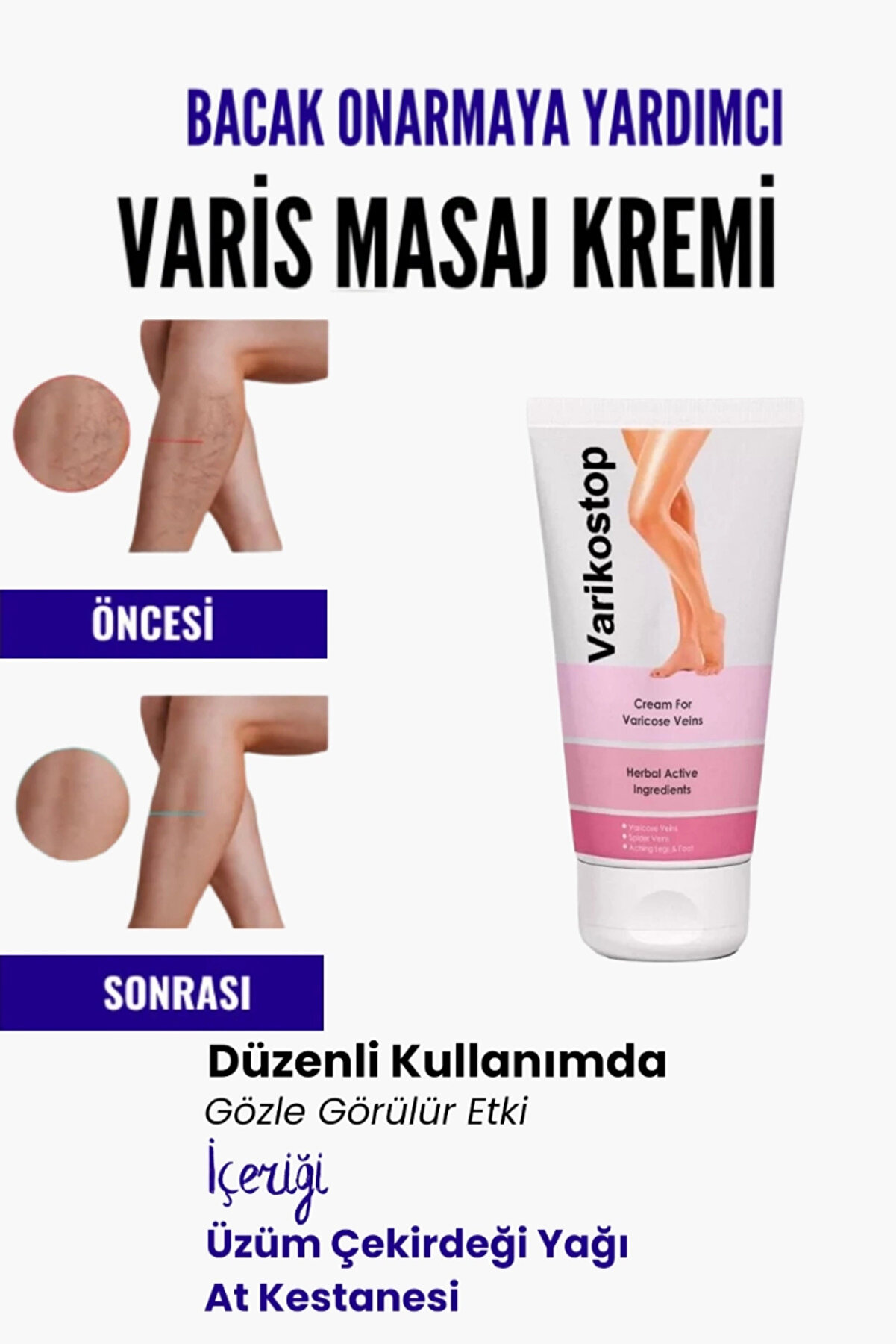 Adoi̇l Var.i̇s Bölgesi̇ Içi̇n Bacak Onarmaya Yardımcı Ve Besleyi̇ci̇ Vari̇kostop Masaj Kremi̇ 200 Ml