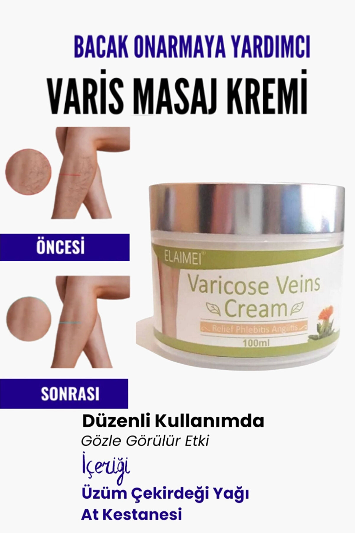 Adoil Var.is Bölgesi Için Bacak Onarmaya Yardımcı Ve Besleyici Varicose Masaj Kremi 100 ml