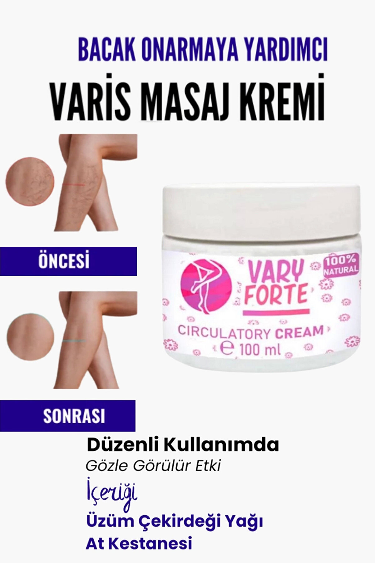 Adoil Var.is B&ouml;lgesi I&ccedil;in Bacak Onarmaya Yardımcı Ve Besleyici Varyforte Masaj Kremi 100 ml
