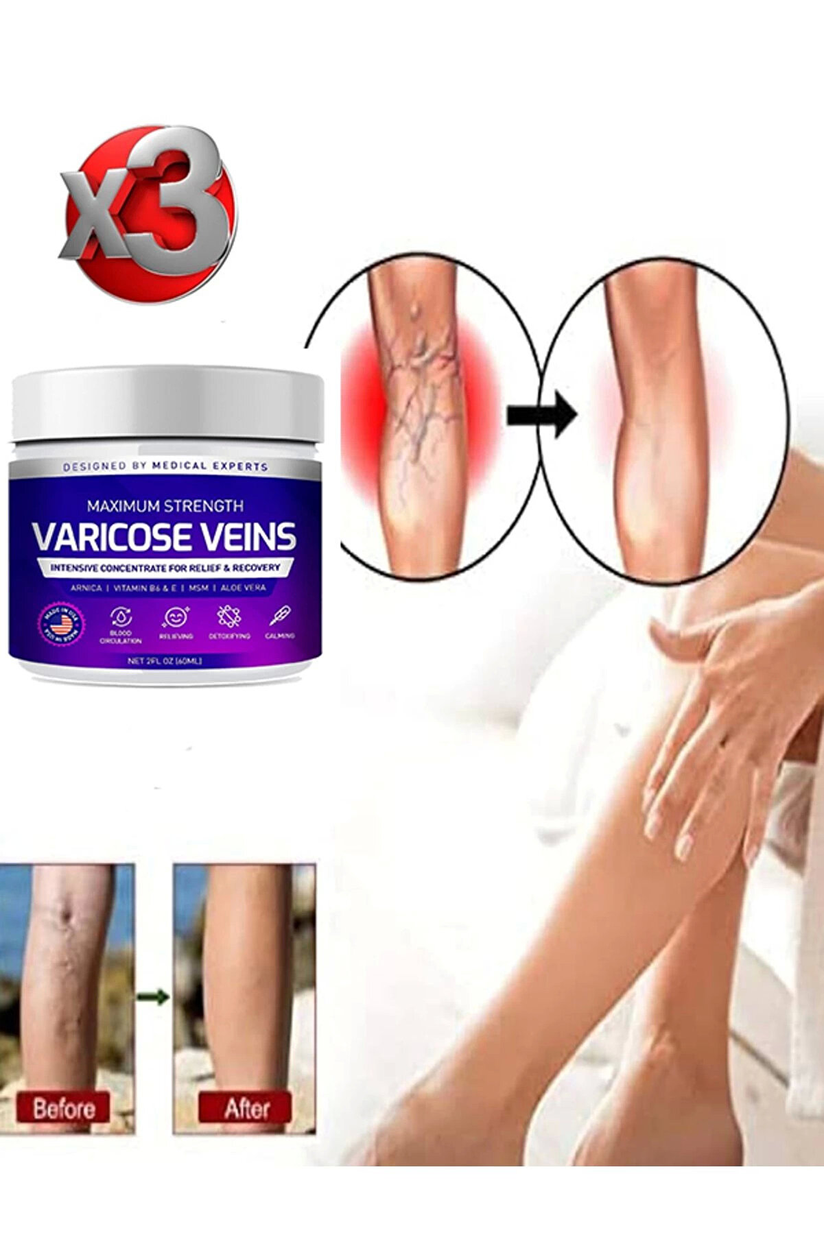 Adoil Maximum Strength Varicose Veins Bakım Kremi 100 ml x 3 adet