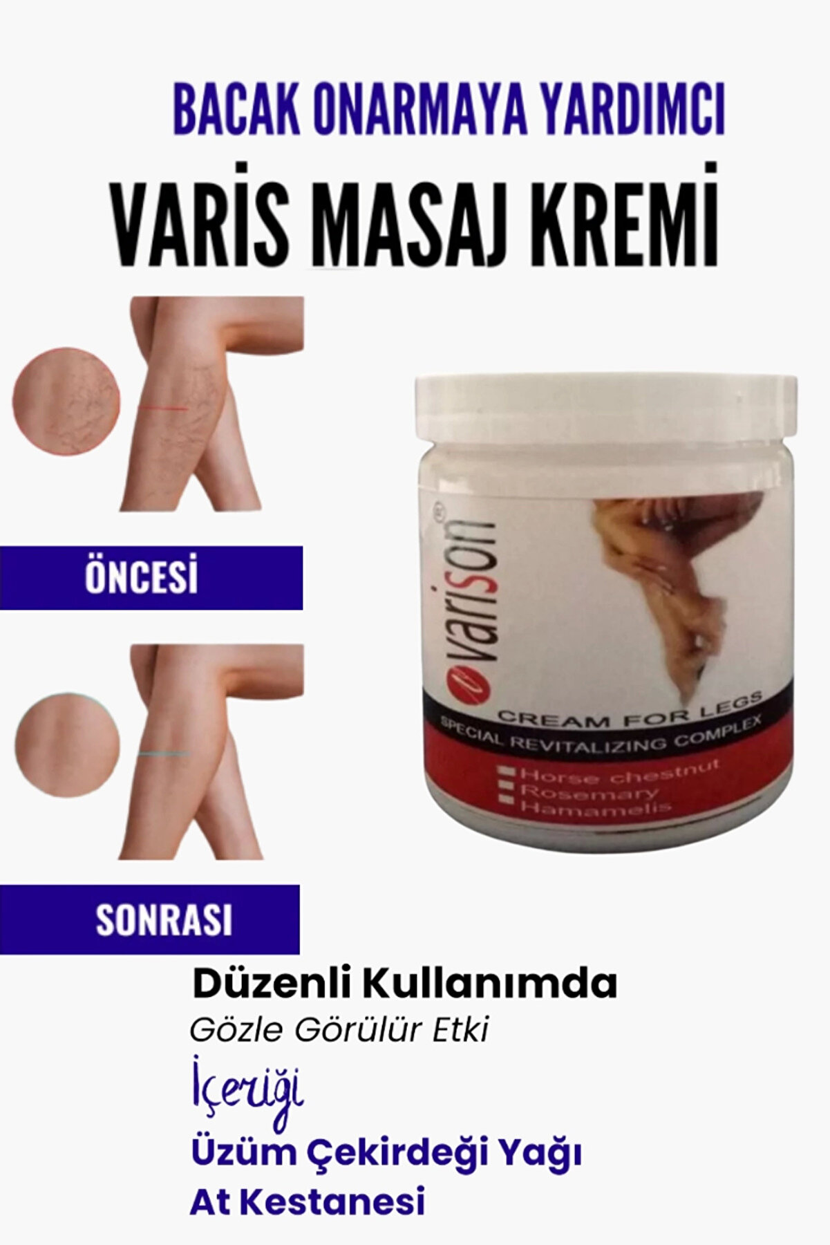 Adoil Var.is B&ouml;lgesi I&ccedil;in Bacak Onarmaya Yardımcı Ve Besleyici Varison Masaj Kremi 200 ml