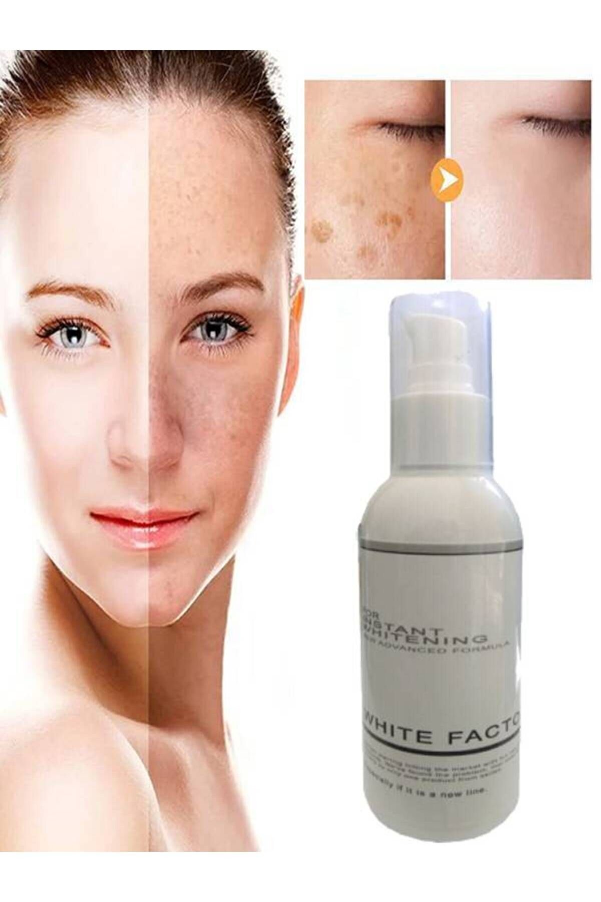 Adoi̇l Whi̇te Factor Ci̇lt Beyazlatıcı Ton Açıcı Krem 120 Ml