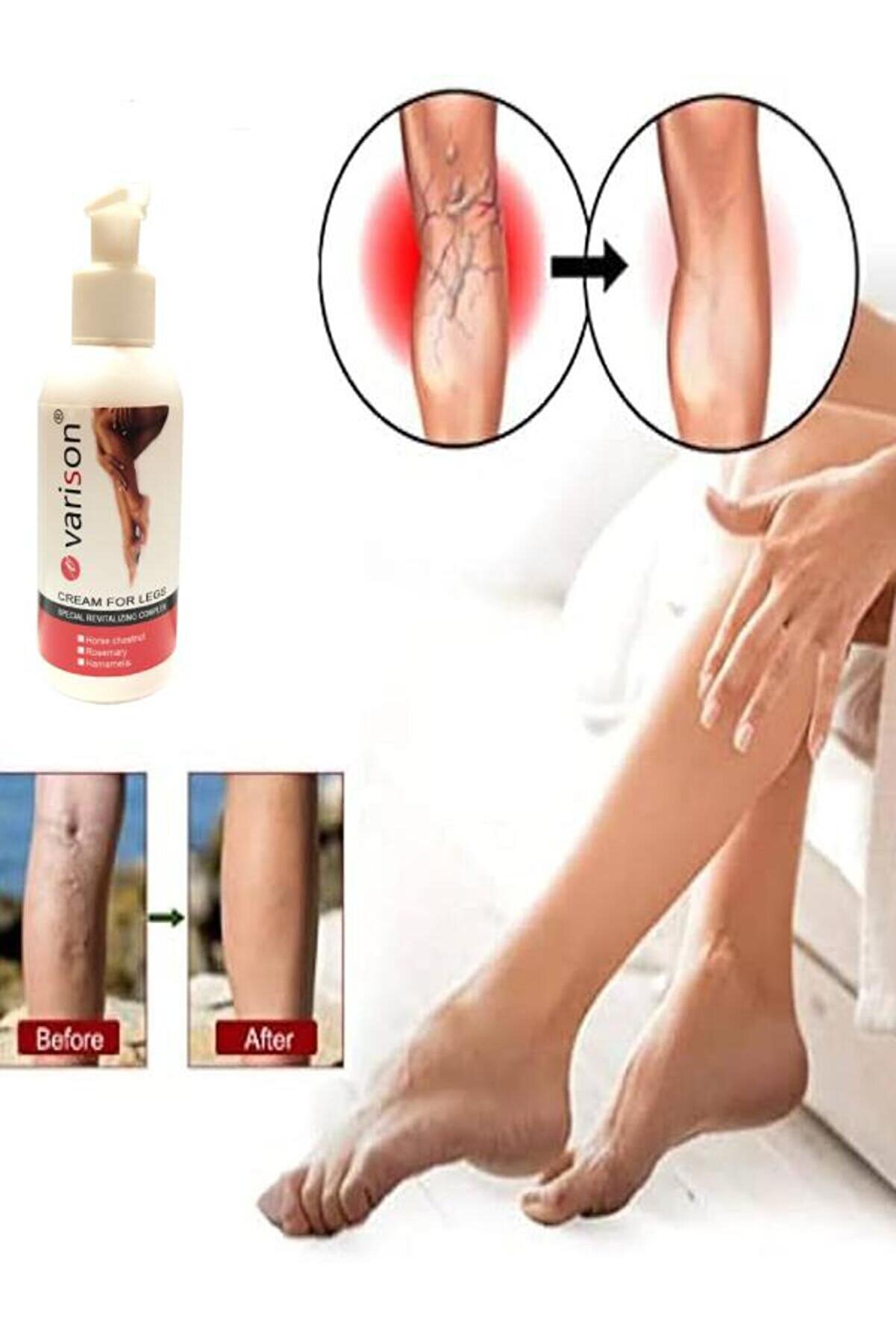 Vari̇son Vari̇.s Sellüli̇t Bacak Bakım Kremi̇ 120 Ml