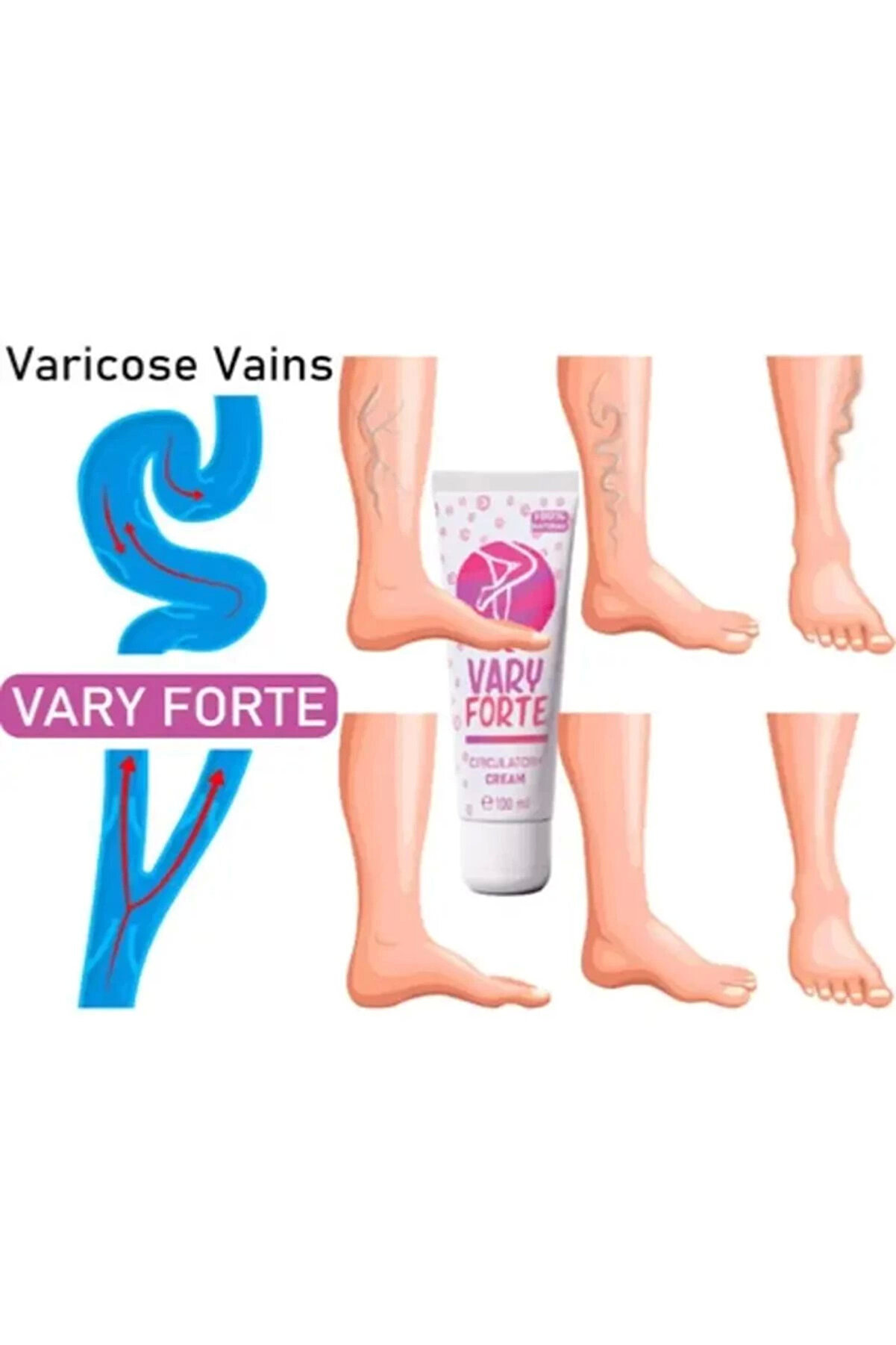 Vary Forte Tüp Yoğun Vari̇sleri̇ni̇ze Güçlü Etki̇de Krem 100 Ml 3 Adet