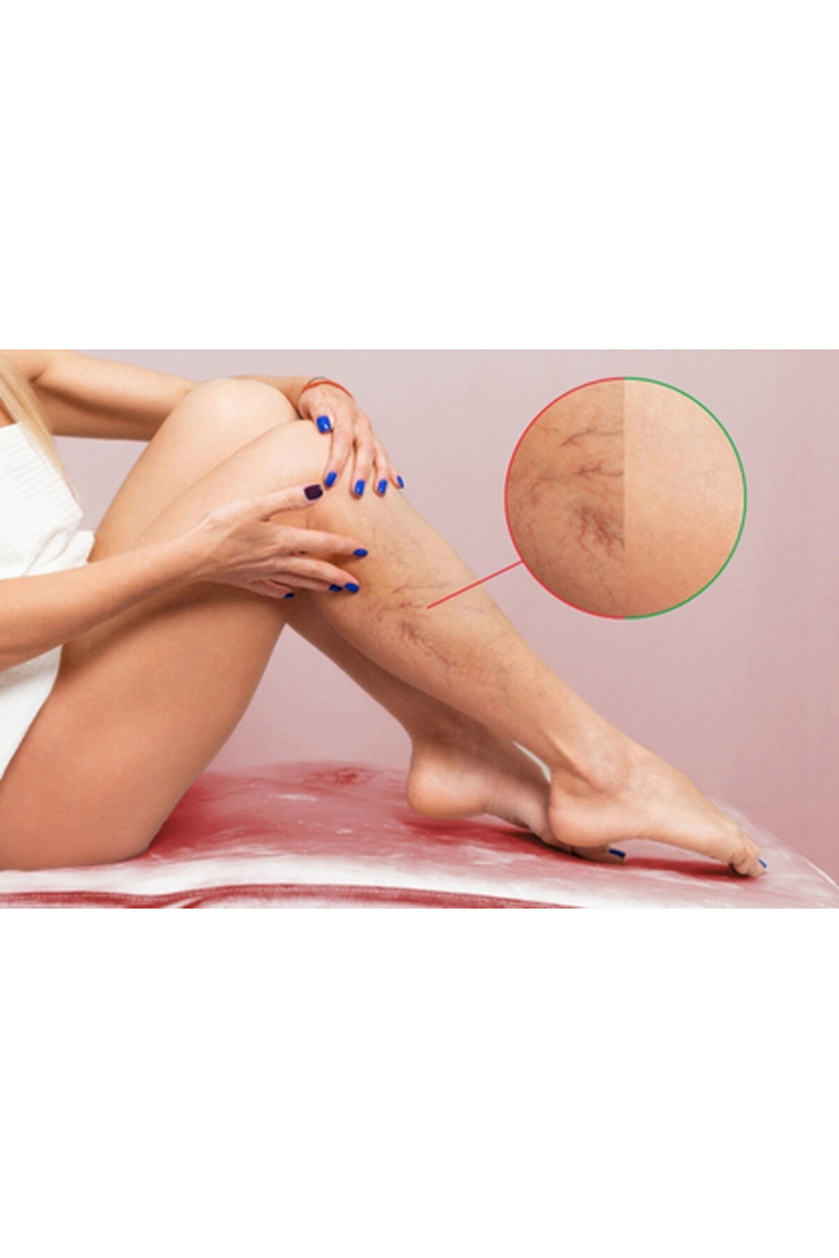 Vari̇cose Vei̇n Defense Cream 150 Ml X 3 Bacaklar İ&ccedil;i̇n Bakım Kremi̇