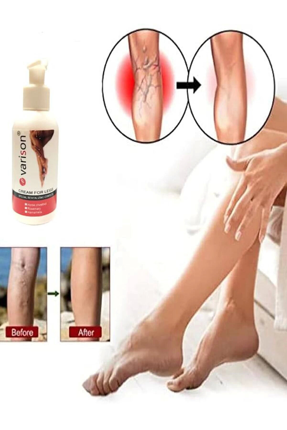 Vari̇cose Vei̇n Defense Var.i̇s Bacak Bakım Kremi̇ 120 Ml X 1 Adet