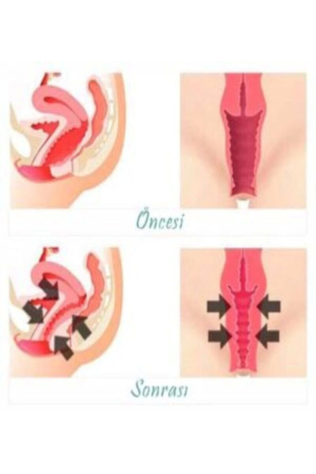 Vagi̇ti̇ght Kadınlar İçi̇n Geni̇tal Bölge Şeki̇llendi̇ri̇ci̇ Krem 100 Ml X 2 Adet