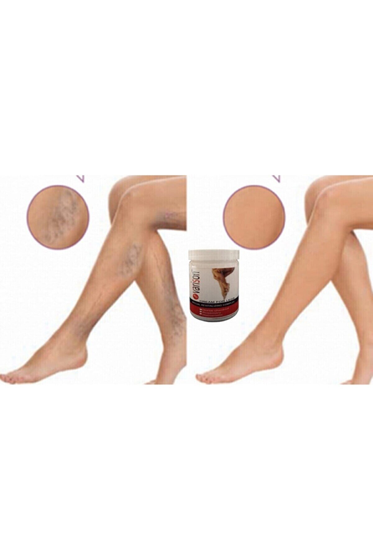 Vari̇son Var.i̇s Selluli̇t Bacak Bakım Kremi̇ 200 Ml