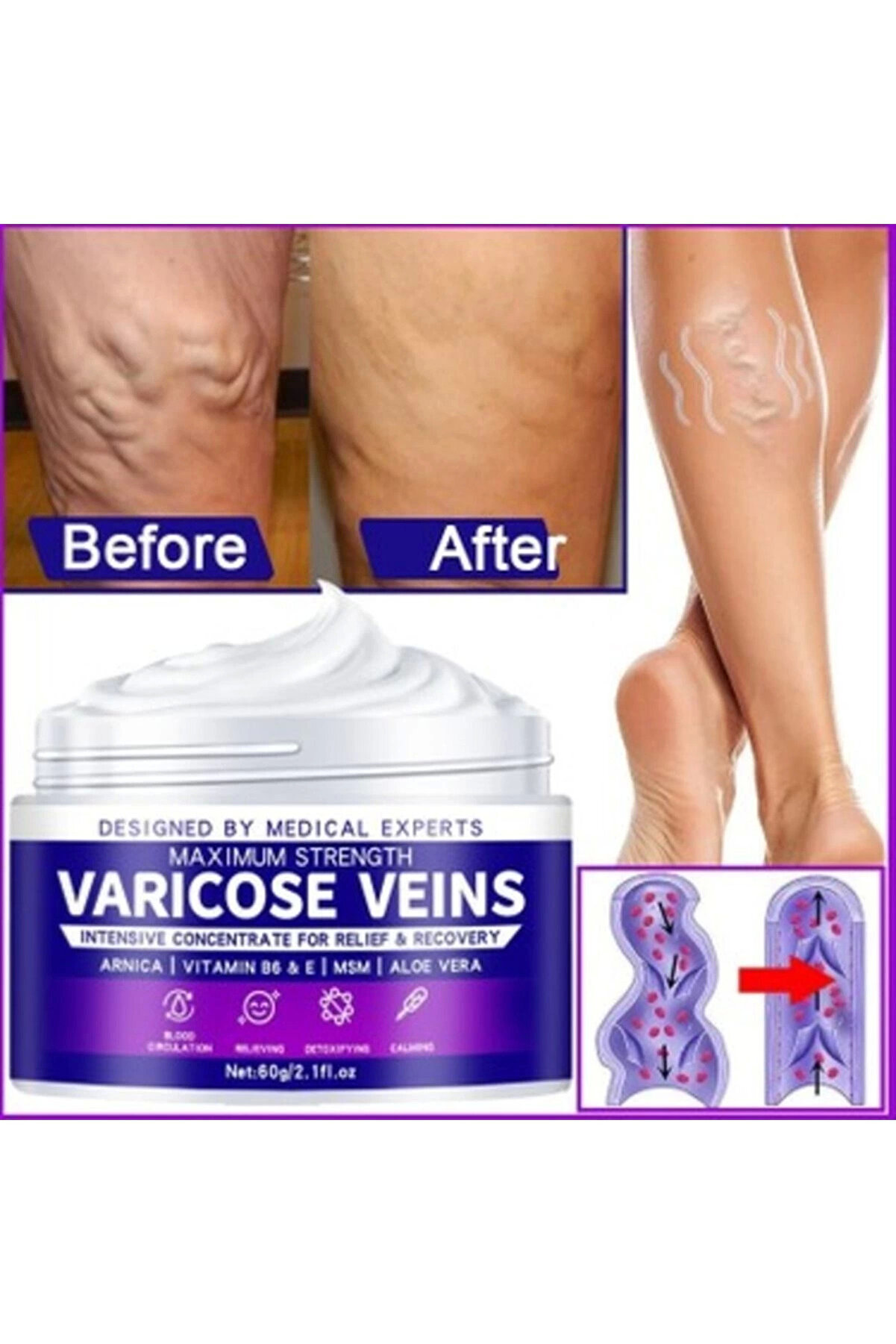 Strength Vari̇cose Vei̇n Tedavi̇ Kremi̇ 100 Ml X 2 Adet