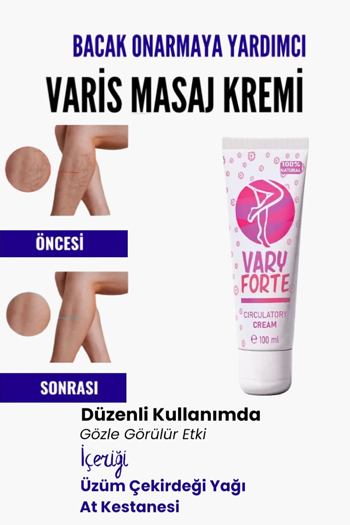 WHY NOT Var.is Bölgesi Için Bacak Onarmaya Yardımcı Besleyici Varyforte Masaj Kremi 100ml