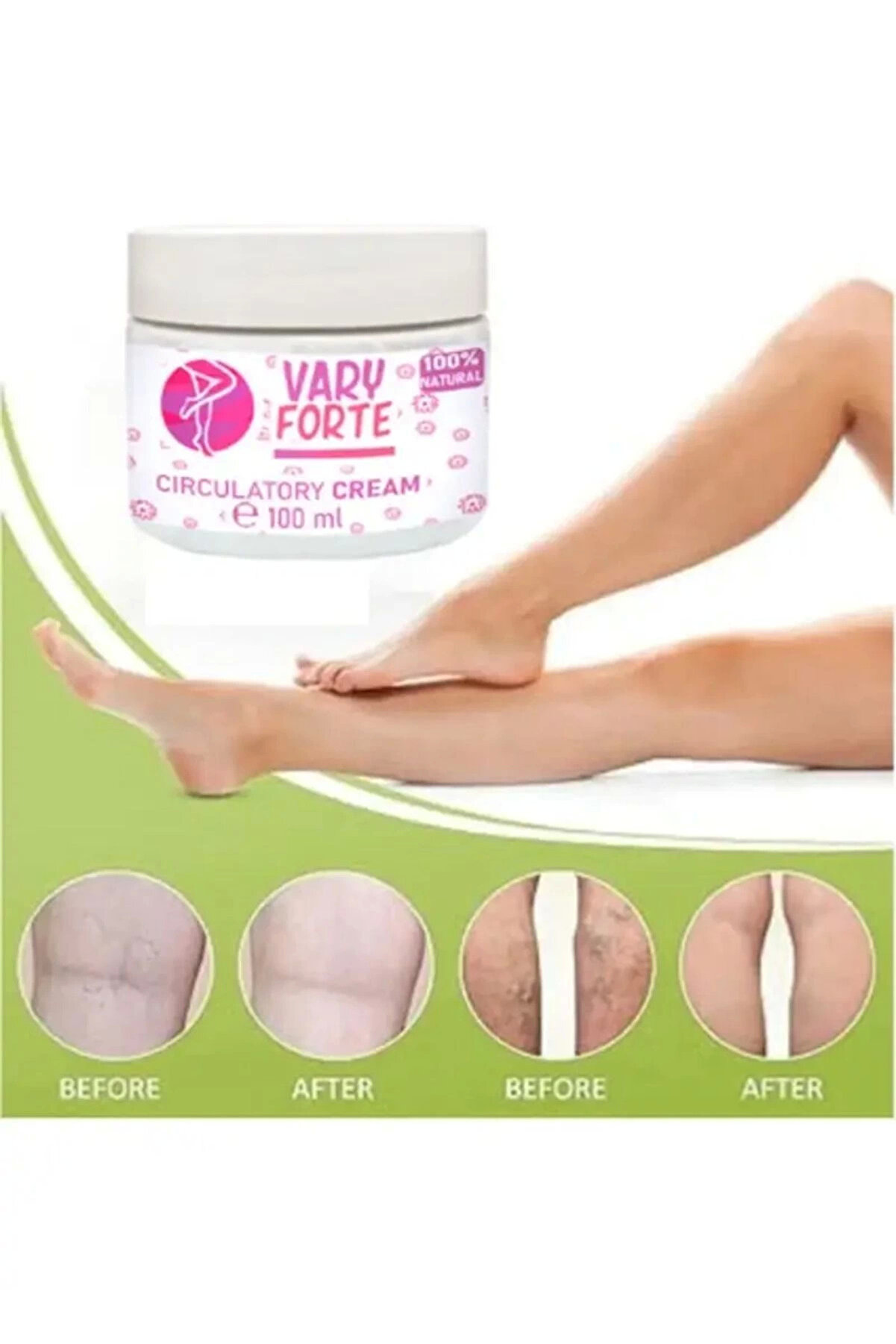 Vary Forte Kavanoz Yoğun Wari̇slere Karşı Tesi̇rli̇ Krem 100 Ml X 3 Adet