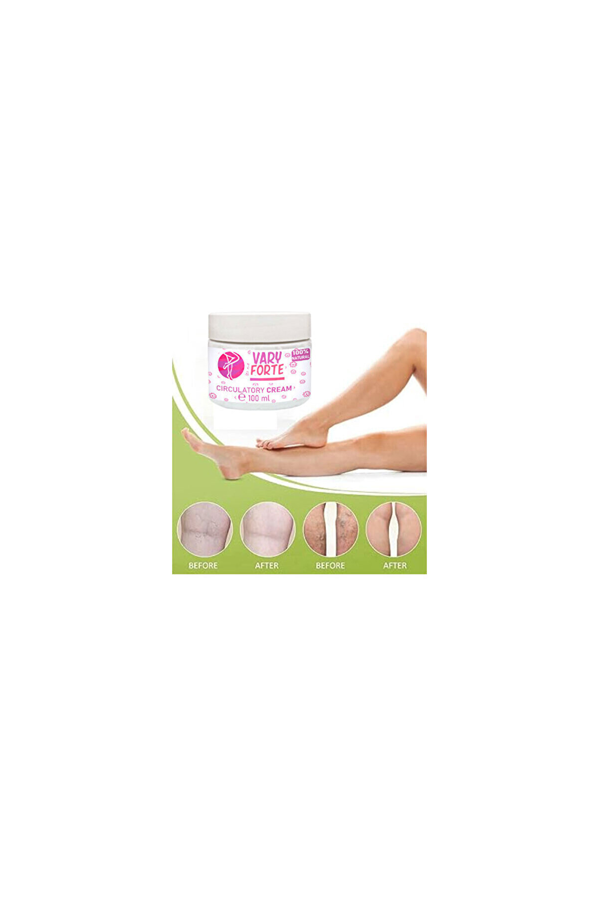 Vary Forte Vari̇sleri̇ni̇ze Karşı Rahatlatmaya Bakım Ve Masaj Kremi̇ 100 Ml X 2 Adet