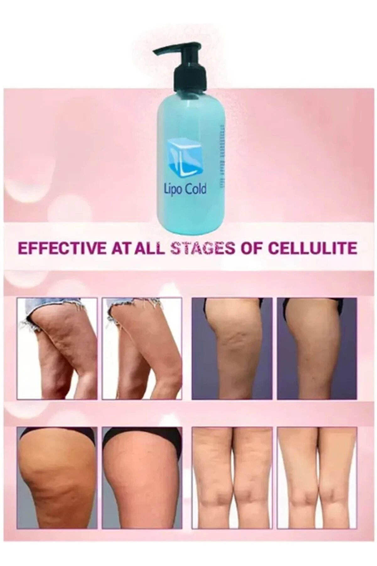 Li̇po Cold Sıkılığa Inceli̇ğe Hafi̇fli̇ğe Ve Selüli̇li̇tleri̇ni̇ze Güçlü Etki̇de Krem 250 Ml X 3 Adet