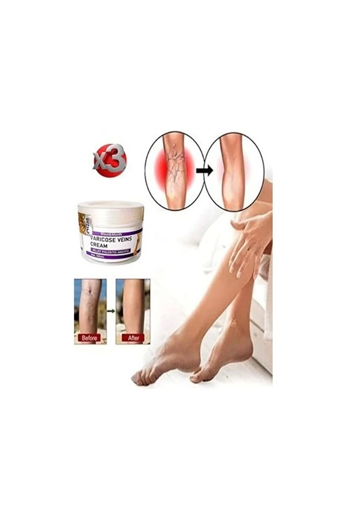 Bravilor Varicose And Spider Veins Soothing Leg Cream Bacak Bakım Kremi 100 ml x 3 Adet