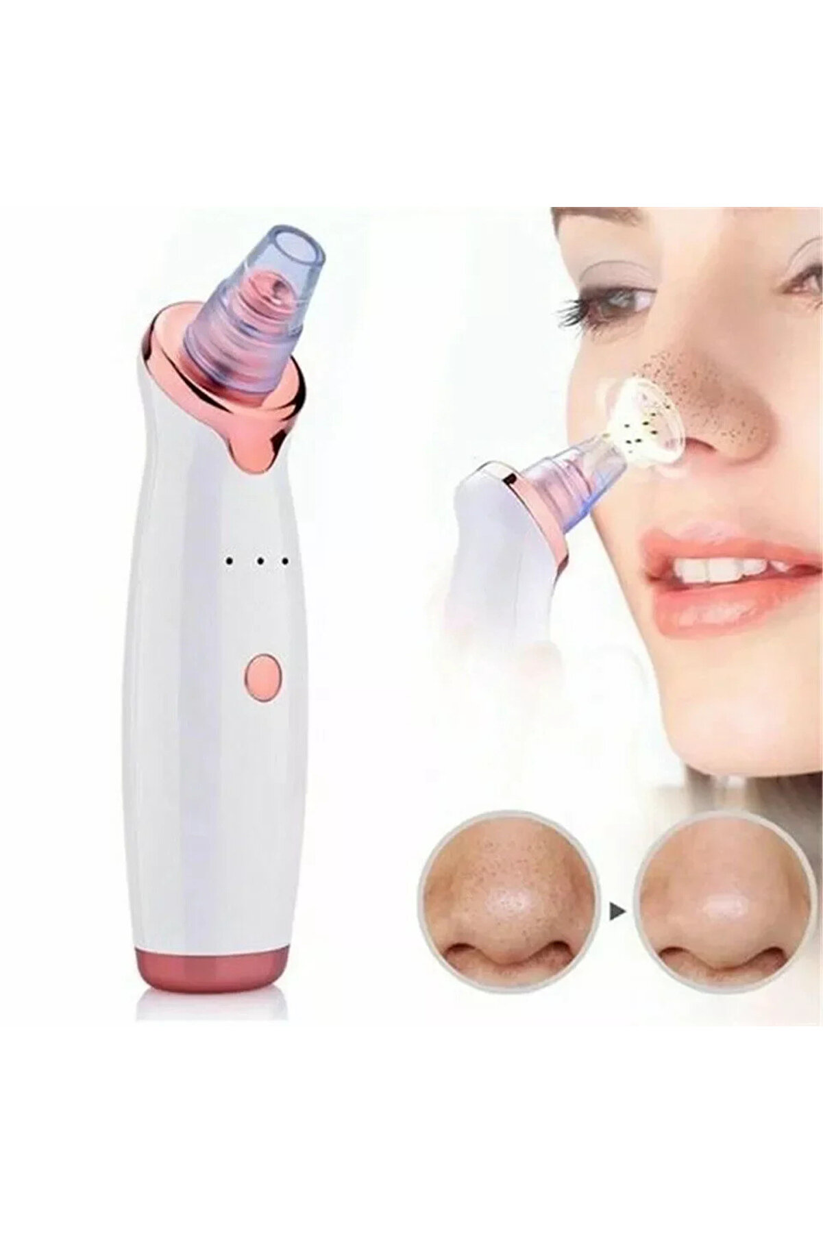 Go İthalat Şarjlı Si̇yah Nokta Temi̇zleme Ci̇hazı 5 Başlıklı (4940)