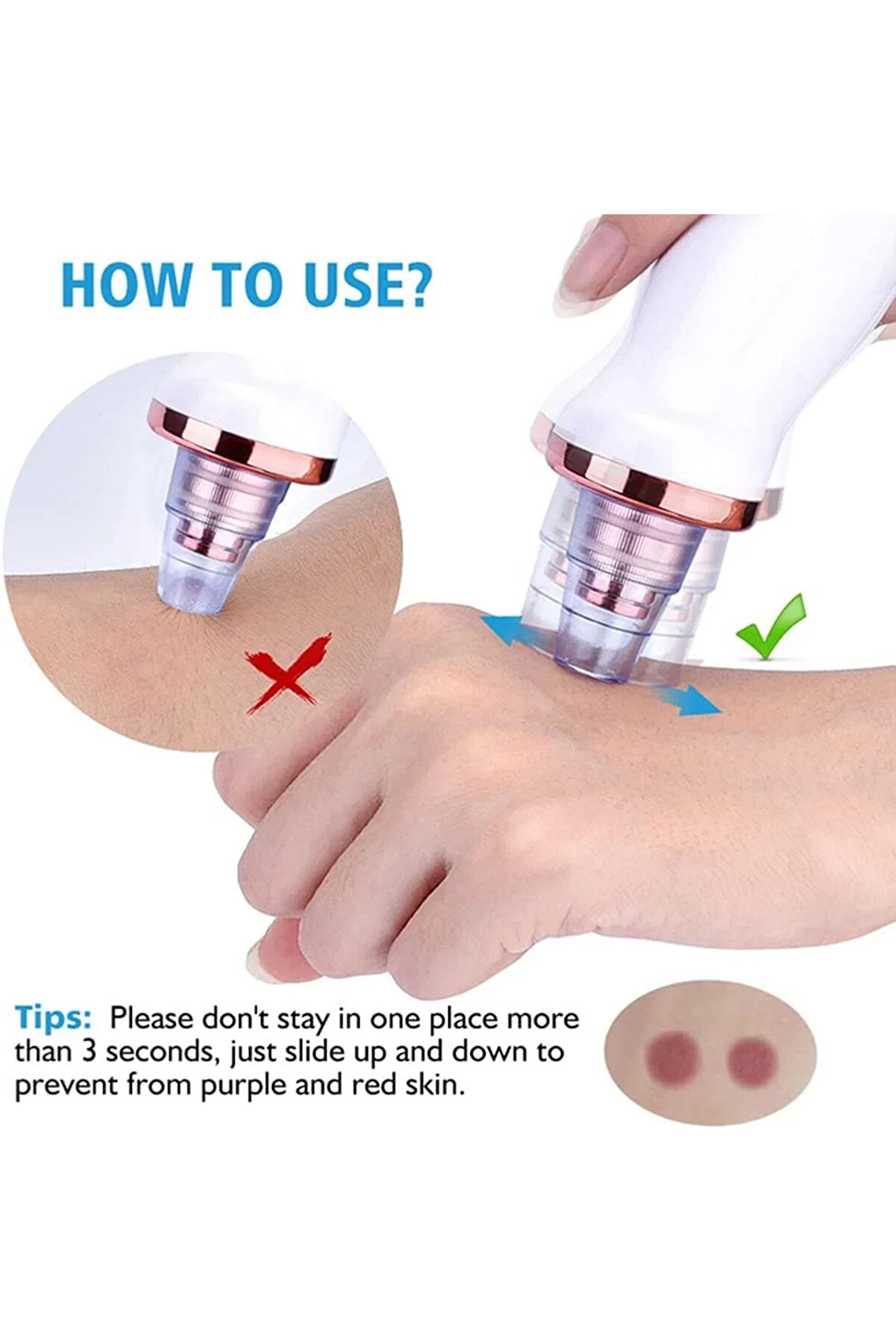 Go İthalat Şarjlı Si̇yah Nokta Temi̇zleme Ci̇hazı 5 Başlıklı (4940)