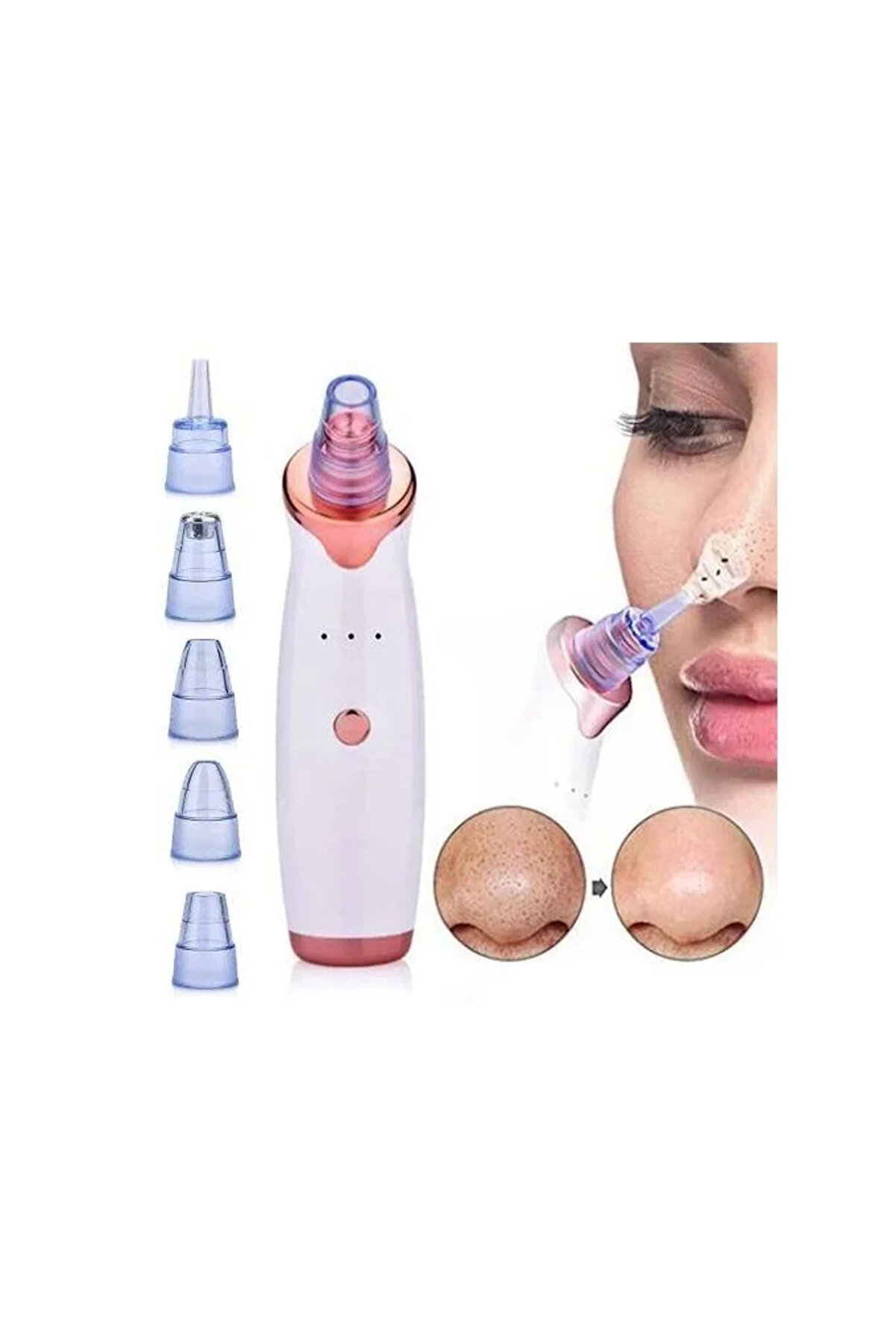 Go İthalat Şarjlı Si̇yah Nokta Temi̇zleme Ci̇hazı 5 Başlıklı (4940)