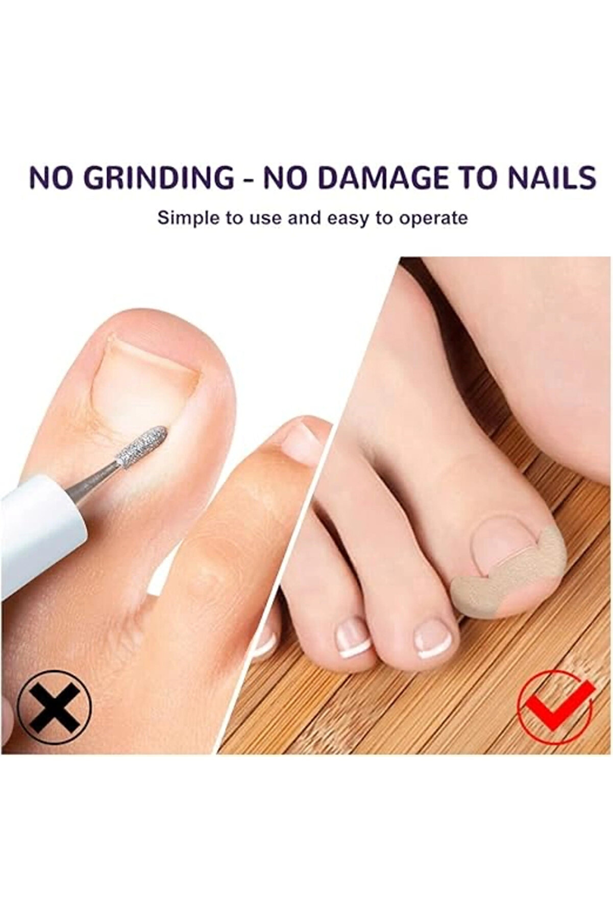 Ayak Tırnağı Düzeltme Bandı 50 Adet