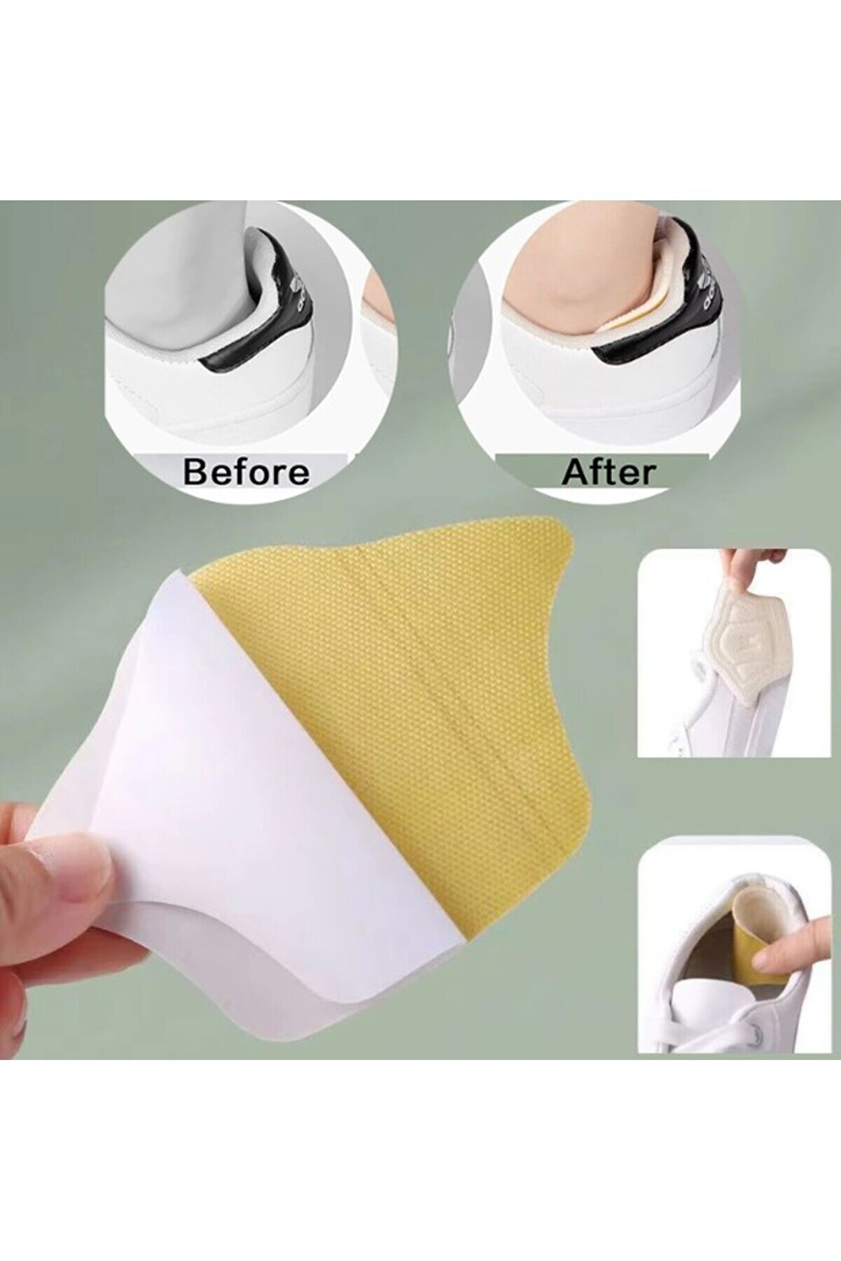 Go İthalat Ta&ccedil; Şeki̇lli̇ 10 Mm Topuk Daraltma Ve Vurma &Ouml;nleyi̇ci̇ (5258)