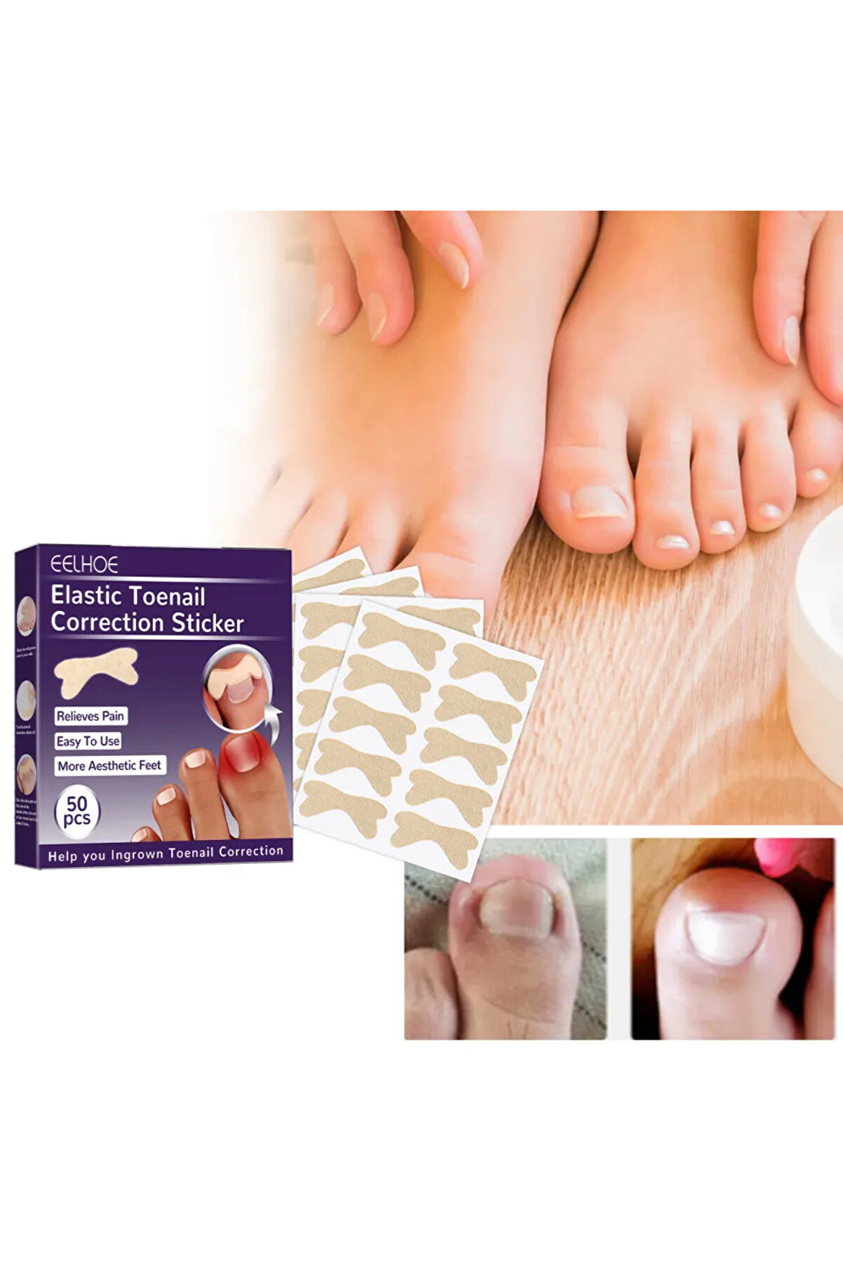 Eco Lounge Ayak Tırnağı Düzeltme Bandı 50 Adet