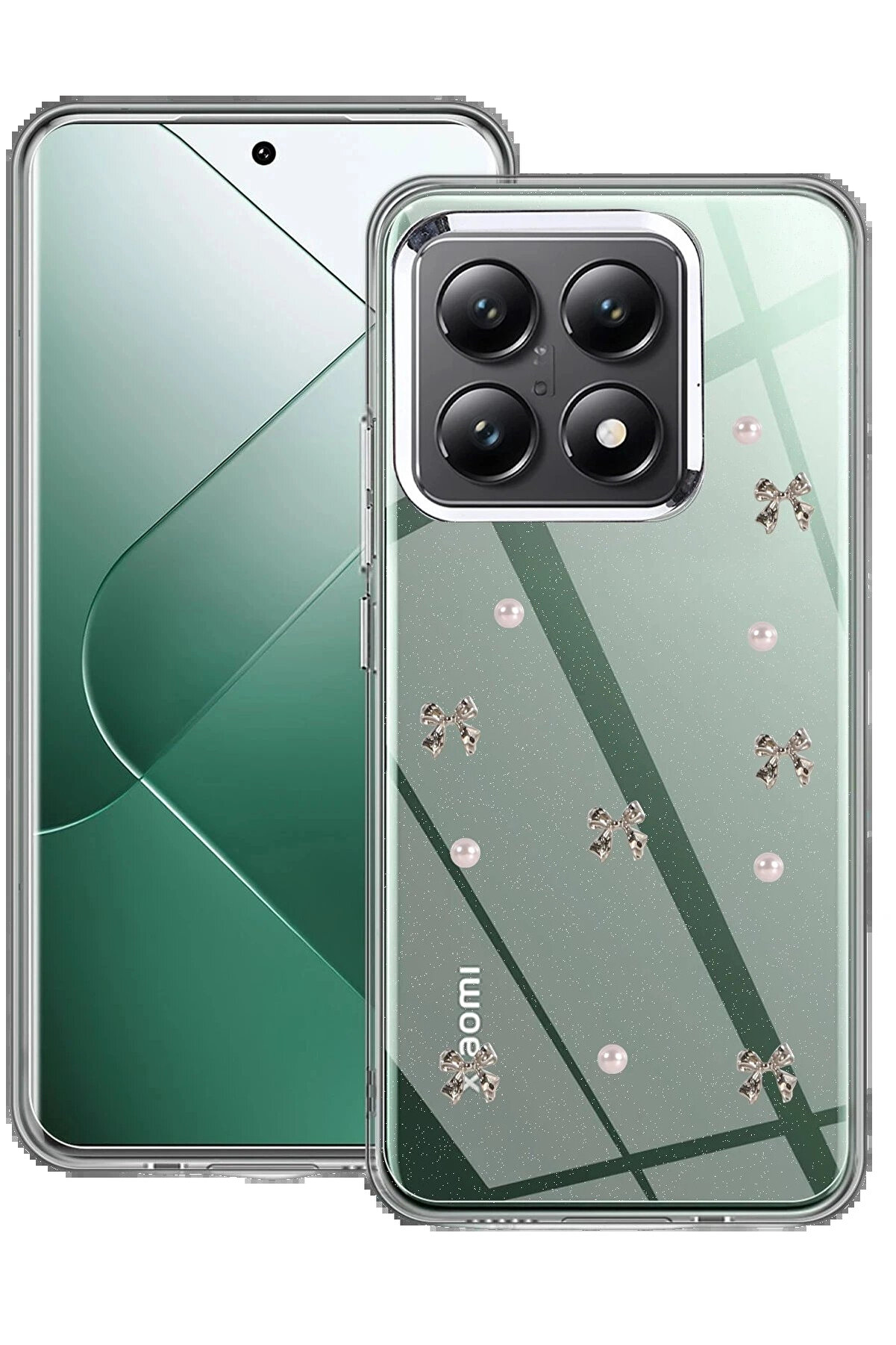 Buti̇k Xi̇aomi̇ Mi̇ 14T Pro Fi̇yonk Desenli̇ Kapak - Desen 8-(5796)