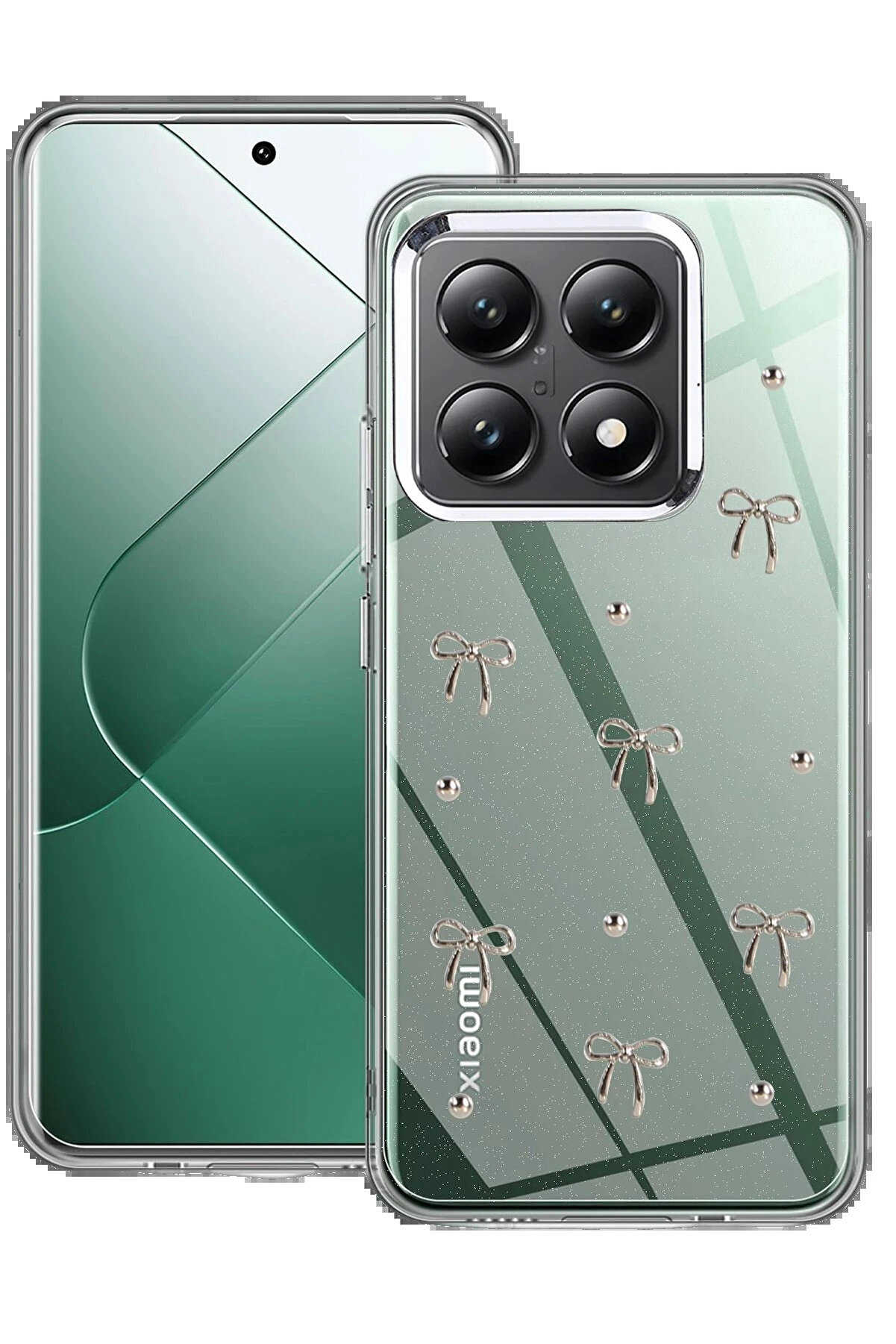 Buti̇k Xi̇aomi̇ Mi̇ 14T Pro Fi̇yonk Desenli̇ Kapak - Desen 5-(5796)