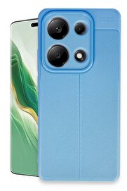 CepteToptan Xiaomi Redmi Note 13 Pro 4G Kılıf Auto Focus Kapak - Mavi - DROPX7070-3655