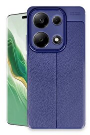 CepteToptan Xiaomi Redmi Note 13 Pro 4G Kılıf Auto Focus Kapak - Lacivert - DROPX4672-8800