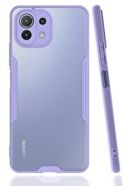 CepteToptan Xiaomi Mİ 11 Lite Kılıf Platin Silikon - Lila - DROPX8123-8468