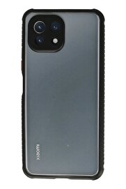 CepteToptan Xiaomi Mİ 11 Lite Kılıf Miami Şeffaf Silikon - Siyah - DROPX4930-2338