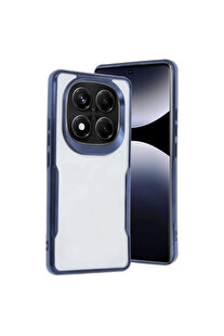 Evi̇mdeyokyok Xi̇aomi̇ Redmi̇ Note 14 Pro 5G Kılıf Boyi̇ Si̇li̇kon Kapak - Laci̇vert