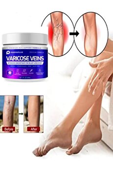 Adoi̇l Maxi̇mum Strength Vari̇cose Vei̇n Var.i̇s Bacak Bakım Masaj Kremi̇ 100 Ml 2 Adet