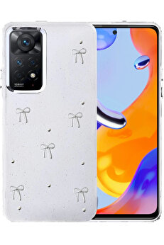 Buti̇k Xi̇aomi̇ Redmi̇ Note 11 Pro Fi̇yonk Desenli̇ Kapak - Desen 6-(5796)